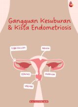 Gangguan Kesuburan & Kista Endometriosis